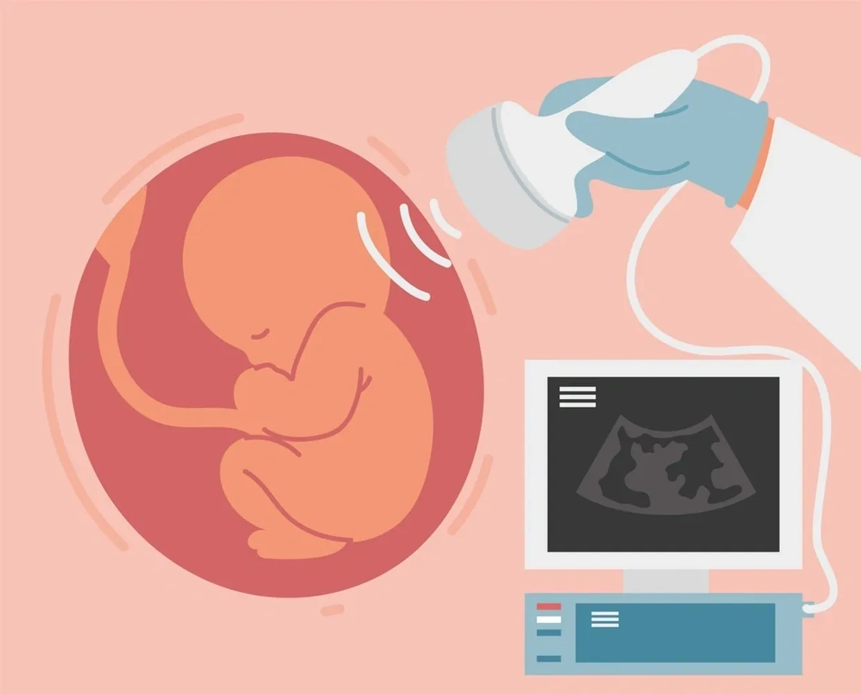 Understanding the Importance of Anomaly Scans During Pregnancy